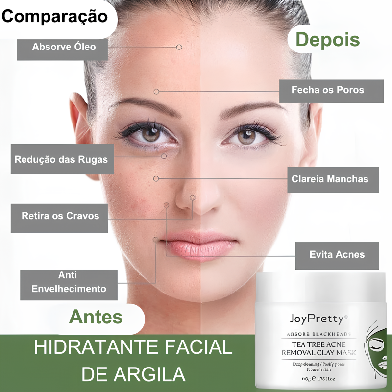 Removedor Facil Aviz - Anti-Acnes e Rejuvenecedor